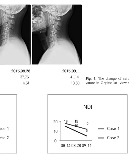 Fig.  5.  The  change  of  cervical  cur- cur-vature in C-spine lat.  view  (Case  2).