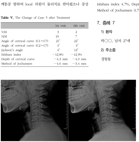Table  V.  The  Change  of  Case  5  after  Treatment