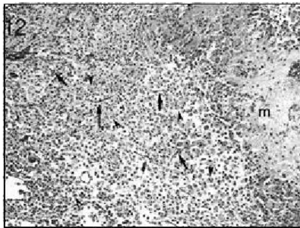 Fig.  10.  Photomicrograph  of  the  rat  brain  from  control  group, 3  days  after  collagenase  injection