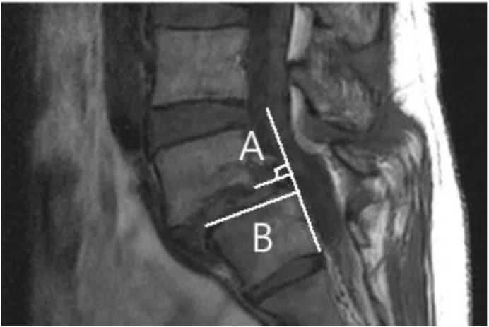 Fig.  1.  T2-weighted  image  obatained  in  a  lateral  plane  of  the lumbar  spine