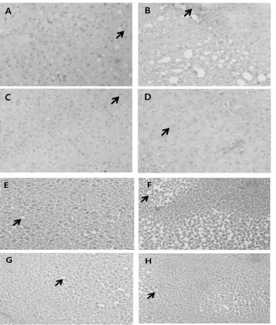 Fig.  8.  Histopathology  of  liver  tissue  with  Oil  Red  O  staining  (A∼D)  and  Hematoxyline  and  Eosin  (E∼H)