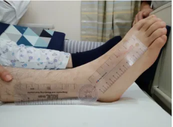 Fig.  1.  Measurement  of  ankle  joint  range  of  motion.