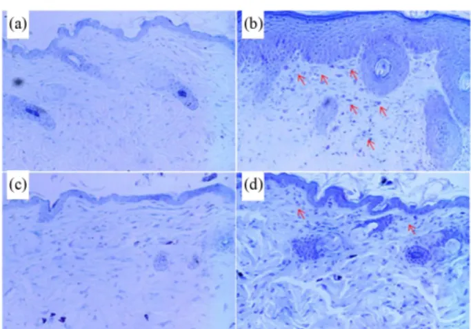 Fig. 6. Histological status of the skin stained with toluidine blue of dorsal skin group in atopic dermatitis-like NC/Nga mice induced by Mite extract.