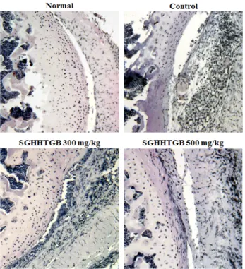 Fig. 11.  Effect  of  SGHHTGB  on  serum  TNF-α  in  BALB/c  mice  with  RA.  Normal  mice  received  neither  injection  nor  treatment  (Normal)