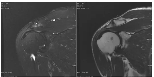 Fig.  4.  Coronal  view  of  Rt. 
