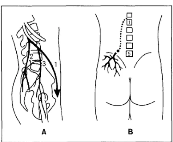 Fig.  1.  (A)  Three  branches  of  the  division  of  the  T12  and  L1  spinal  nerve