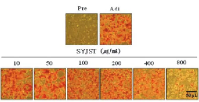 Fig.  3. Inhibitory effect of Seungyangjeseup-tang extract (SYJST)  on  the  3T3-L1  adipogenesis  compared  to  control  group