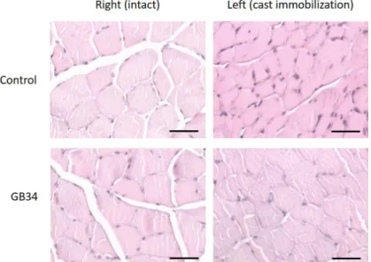 Table Ⅱ. Effect of GB34 on Cross Sectional Area of Gastrocnemius  in  Disuse  Muscle  Atrophy