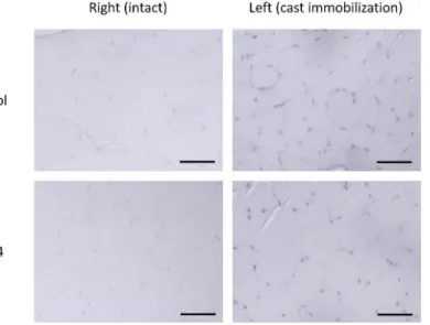 Table  Ⅲ.  BAX  Immunoactivities  of  Gastrocnemius  Muscles  in  Rats  of  Control  and  GB34  Groups.