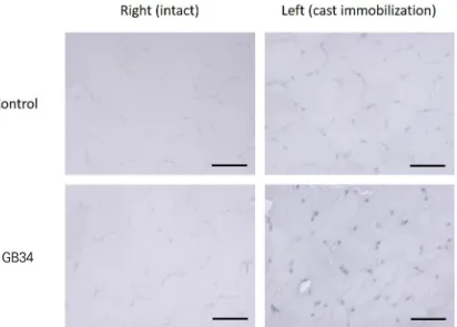 Table  Ⅳ.  Bcl-2  Immunoactivities  of  Gastrocnemius  Muscles  in  Rats  of  Control  and  GB34  Groups