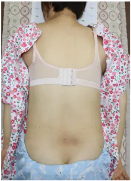 Fig.  4.  Visual  observation  of  the  pelvis  and  spine  in  case  1.• 2018년 6월 13일:  NRS  3,  요통 및 하지 저림 증상이 많이 개선되어 석촌호수(길이 2.5 km)를 한 바퀴 걸을 수 있음