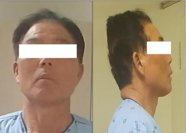 Figure 1-A. Anterior view of face (2019-11-18) Figure 1-B. Lateral view of face (2019-11-18)