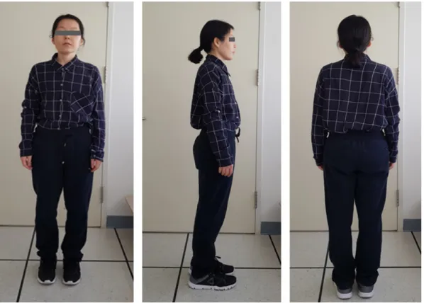 Figure 1. Anterior view and lateral view of full-length (2018-11-02)