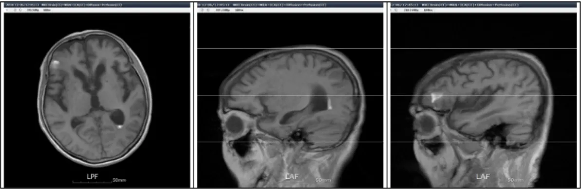 Figure 2. Front view of the patientFigure 1. Brain-MRI(CE) (2018.12.6)