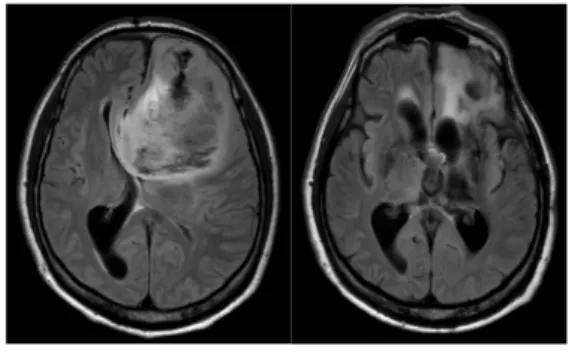 Fig. 1. Brain MRI (L) 2019.01.15.