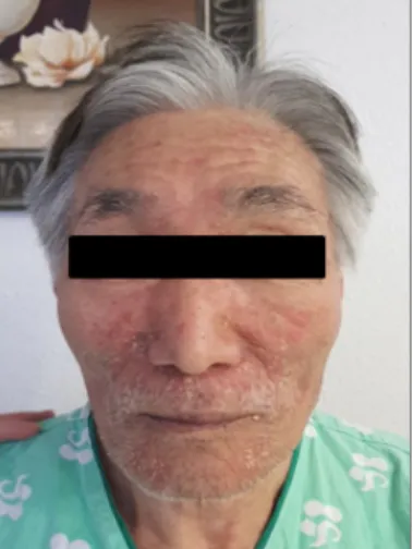 Figure 1. Anterior view of face