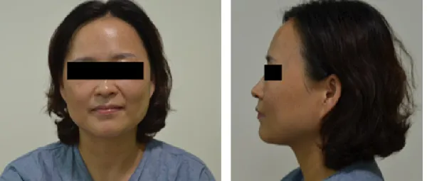 Figure 1. Anterior and lateral view of the face captured by Nikon D5100 