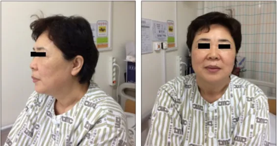 Figure 1. Anterior and lateral view of the face