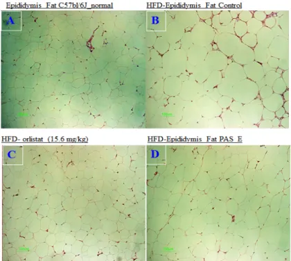 Figure 10. Effect of PAS_E † (100 mg/kg) extracts on histological profiles of epididymal adipose tissue in obese mice fed high fat diet.