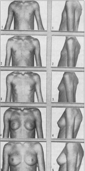 Figure 1. Standards for breast ratings (from Tanner 7 , 1969)