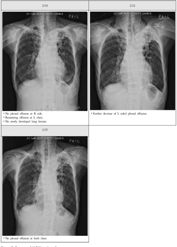 Figure 7. Progress of X-RAY and reading