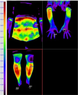 Figure 1. Digital infrared thermographic imaging