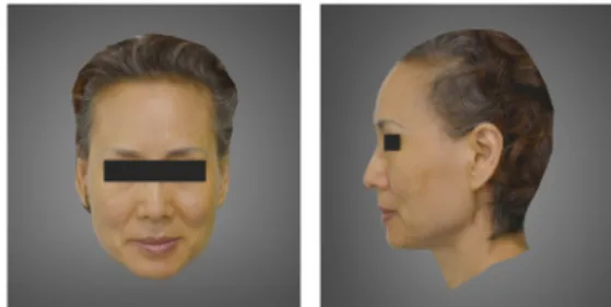 Figure 1-A. Anterior and lateral view of the face - case 1