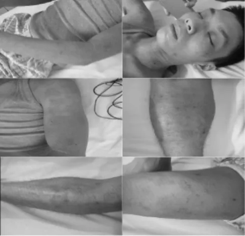 Figure 1-A. Visual change of patient (2014.3.17.)