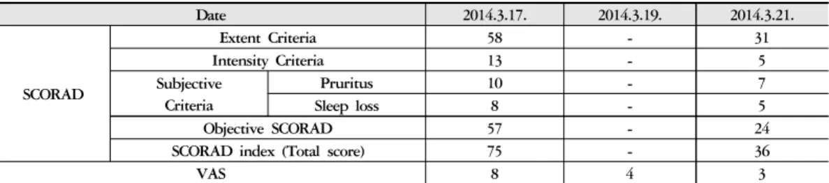 Table 2. Clinical Progress of SCORAD 1)  index and VAS 2) Date 2014.3.17. 2014.3.19. 2014.3.21