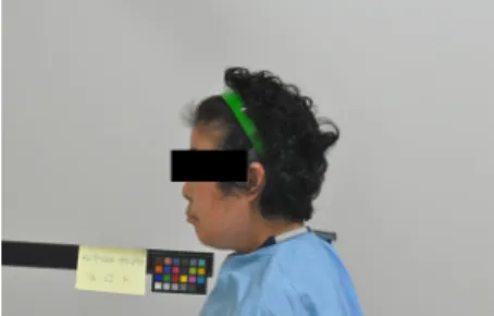 Figure 1. The frontal and lateral side of face ⑤  ASIS  연결 횡행직선상 거리 : 29.8 ㎝ (2) 용모사기 :  얼굴의 턱 부분이 뾰족하고 눈이  위로 약간 올라가 있음