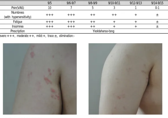 Figure  1.  Picture  of  vesicles(9/5)  Figure  2.  The  change  of  vesicles(9/15)