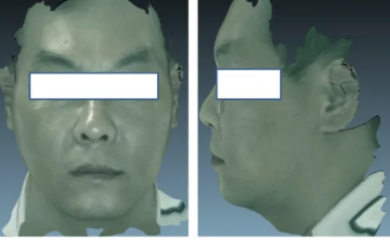 Figure 1. The front and lateral side of the patient클이 보이며 피곤해 보이는 인상을 보임. ③ 성질재간(性質才幹): 차분한 편이고 외향적이지는 않아서 움직이기보다는 조용히 혼자 일을 추진하는 편이고 생활이 일반적으로 꾸준한 편으로 인내심이 많다고 한다