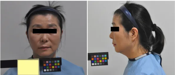 Figure 1. Face of patient(frontal view) Figure 2. Face of patient(lateral view)복용함. 이후 지속되는 주소증으로 보다 적극적인 한