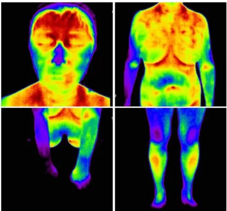 Figure 4. DITI on whole body(before) - 2011.08.02  瘡病,  虛勞夢泄證 등의 병증이 燥熱證의 범주에  속한다 15 