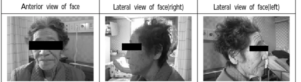 Figure  1.  Face  of  the  patient