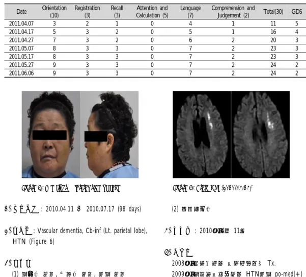 Figure  5.  The  front  &amp;  lateral  side  of  face Figure  6.  Brain  MRI  (2010.04.14) 2) 치료기간 : 2010.04.11 ～  2010.07.17 (98 days)