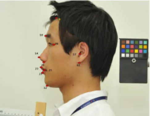 Fig. 1. 11 Points for distance, angle, ratio variable in front face. Fig. 2. 11 Points for distance, angle, ratio variable in lateral face.