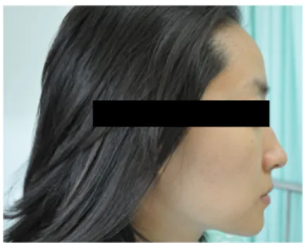 Fig. 1. Frontal view of face Fig. 2. Lateral view of face