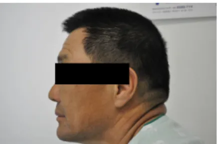 Fig. 1. Frontal view of face Fig. 2. Lateral view of face