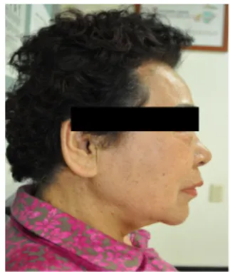 Fig. 4. Frontal view of face Fig. 5. Lateral view of face