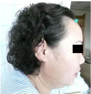 Fig.  1.  Patient's  Anterior  view Fig.  2.  Patient's  Rt.  lateral  view 5.  과거력 : 1)  자궁근종 :  1999년 ○○병원에서 자궁적출  수술 받음