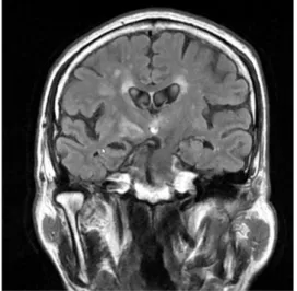 Fig.  3.  Brain  MRI(2008.  4.  3) Fig.  4.  Brain  MRI(2008.  4.  3)6.  가족력 :아버지,  어머니,  큰형 당뇨7