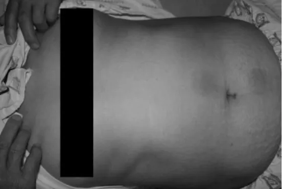 Fig.  1.  Patient's  Anterior  View Fig.  2.  Patient's  Abdomen  View 4)  素症 ①  睡眠: 평소 잘 주무셨으나 裏急後 重으 로 인하여 밤중 내내 화장실에 다니심