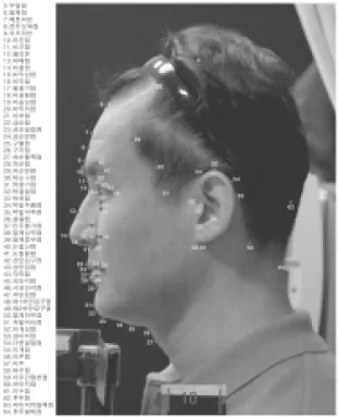 Fig.  3.  측면측정점 Fig.  2.  정면 측정점 정점이 총 46개로 각 측정점마다 좌,  우측 의 고경, 폭경, 방사경과 좌우간폭경 등 7개  측정항목이 계측되므로 322개의 측정항목 을 얻게 되며,  5개의 얼굴중앙선상 고경측 정항목이 얻어진다 13) 