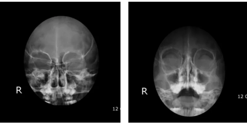 Fig. 2. PNS Water's and Caldwell View(23 May 2007)