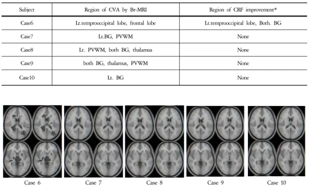 Figure  3.  r-CBF  Change  by  SISCOM  in  Control  GroupTable  4.  SPECT  Analyzed  SISCOM  of  Control  Group