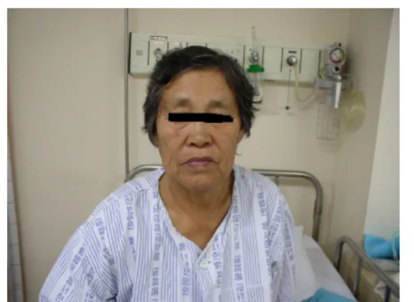Fig 1. The frontal appearance of patient 4)性情 성격은 느긋한 편으로 사람들과 어울리기 좋아 하고 화투를 좋아한다 하였다, 