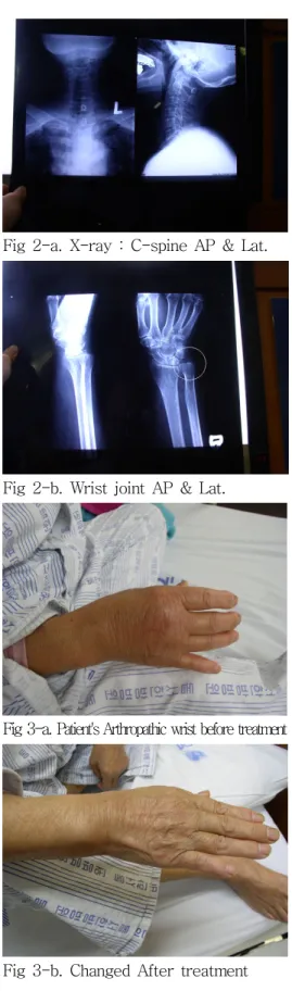 Fig 2-b. Wrist joint AP &amp; Lat.