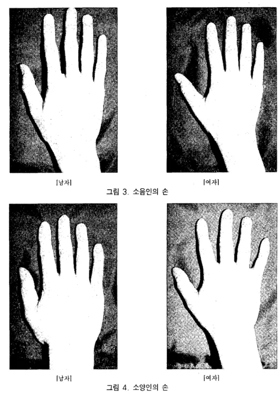 그림 3. 소음인의 손