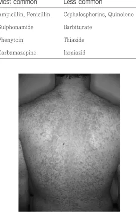 Fig. 1 Exanthematic drug reaction